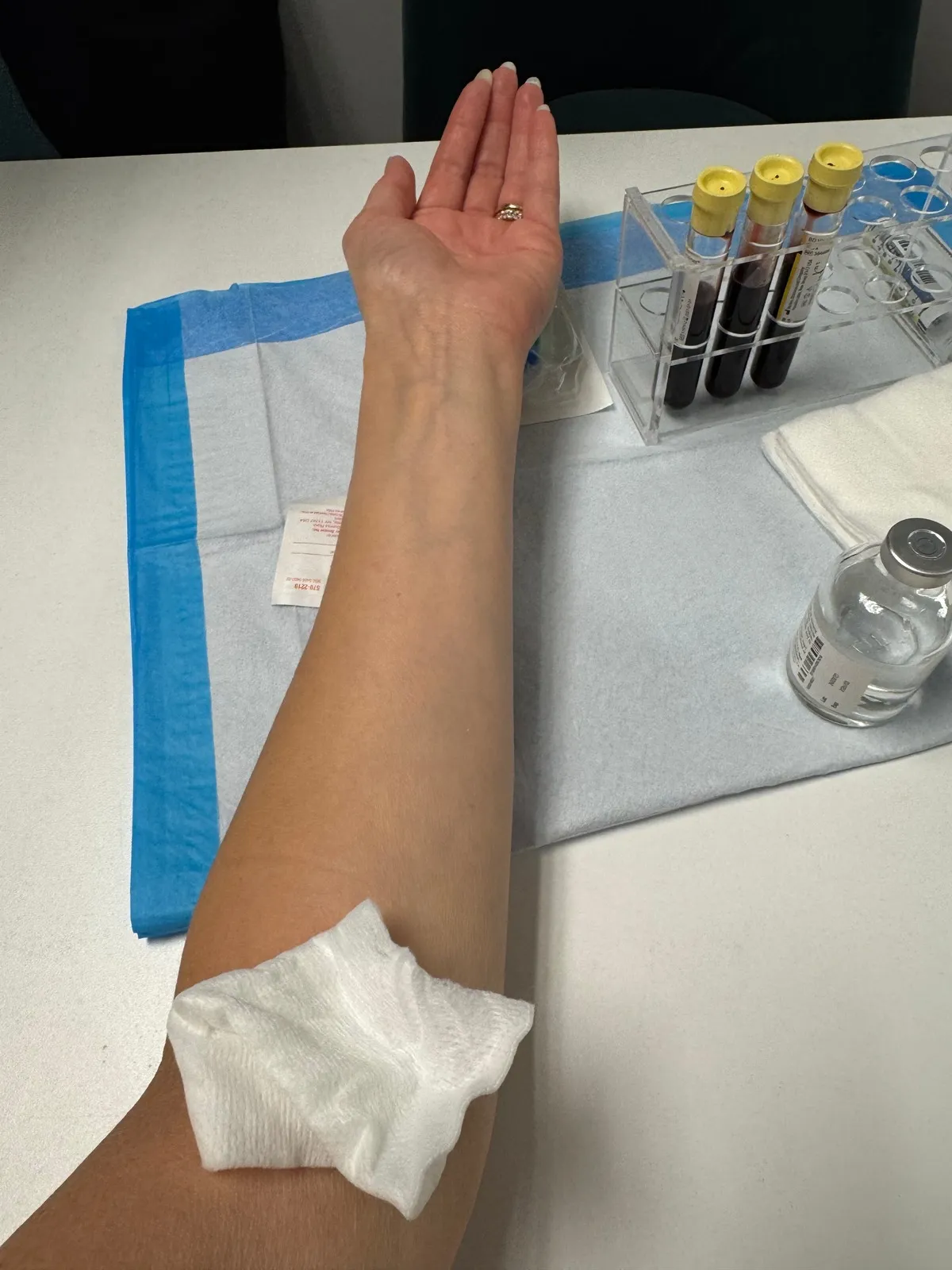 An arm rests on a draped table after the blood draw that starts a PRP visit, beside a rack of collection tubes at Amy's Harrisburg medspa.